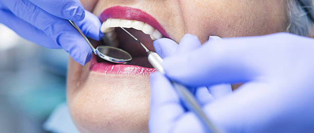 Best Emergency Wisdom Teeth Removal in Elkhart, KS